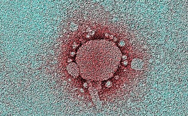 新型肺炎乙类传染