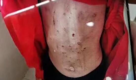 警方通报黑龙江女童被虐打事件