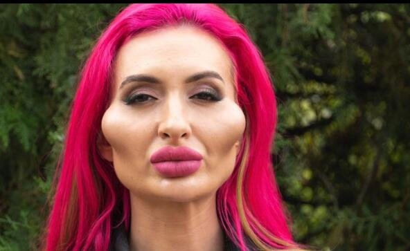 网红模特自称拥有世界最大脸颊