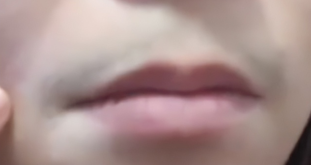 可能导致女性长胡子的原因